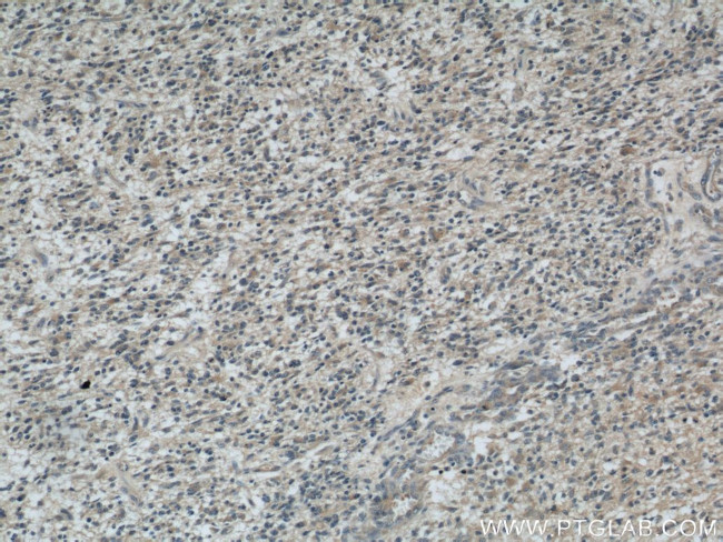 ROMO1 Antibody in Immunohistochemistry (Paraffin) (IHC (P))