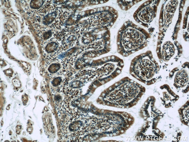 WNT6 Antibody in Immunohistochemistry (Paraffin) (IHC (P))