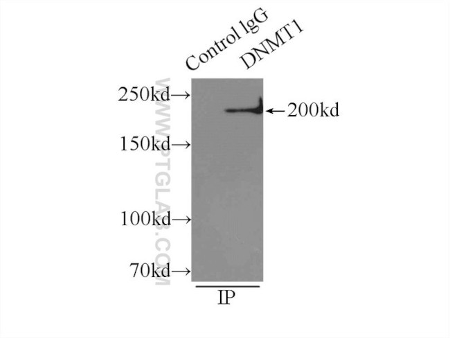 DNMT1 Antibody in Immunoprecipitation (IP)