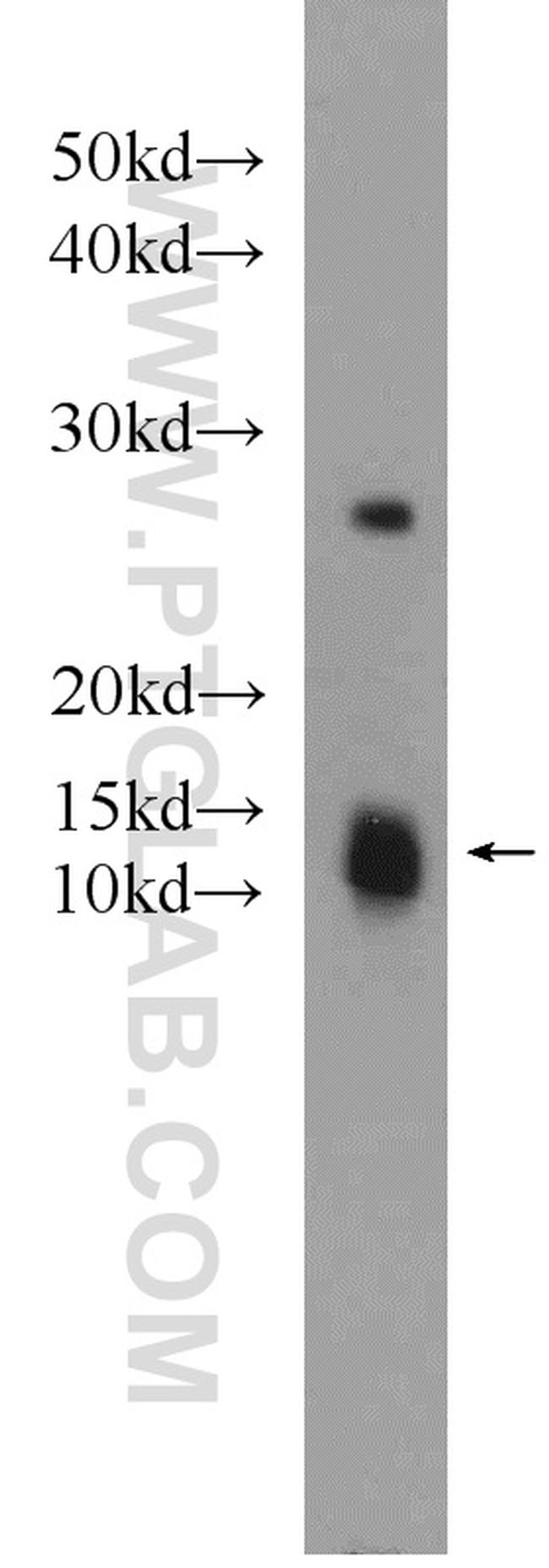 C1orf31 Antibody in Western Blot (WB)