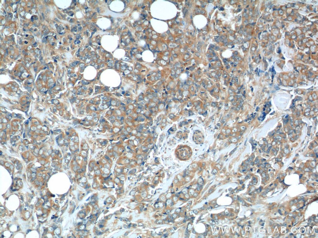 C7orf47 Antibody in Immunohistochemistry (Paraffin) (IHC (P))