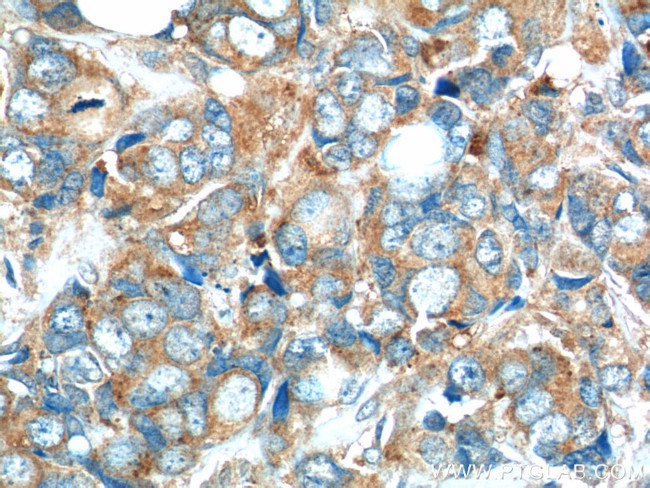 C7orf47 Antibody in Immunohistochemistry (Paraffin) (IHC (P))