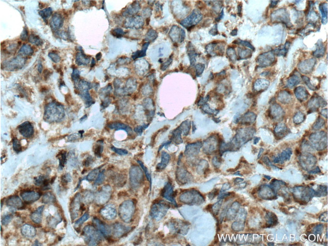 C7orf47 Antibody in Immunohistochemistry (Paraffin) (IHC (P))