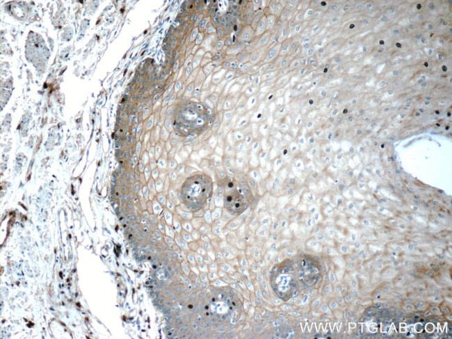 GJB6 Antibody in Immunohistochemistry (Paraffin) (IHC (P))