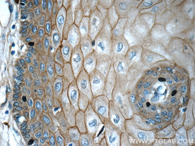 GJB6 Antibody in Immunohistochemistry (Paraffin) (IHC (P))