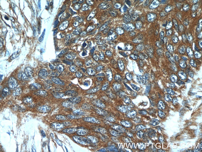 GJB6 Antibody in Immunohistochemistry (Paraffin) (IHC (P))