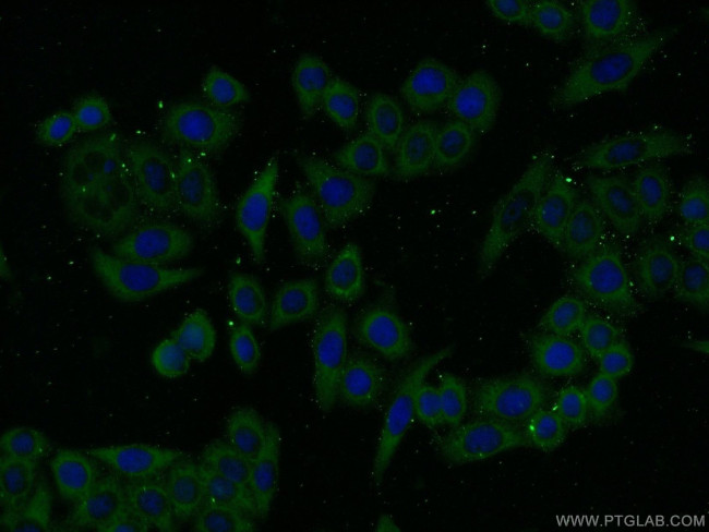 PHKA1 Antibody in Immunocytochemistry (ICC/IF)