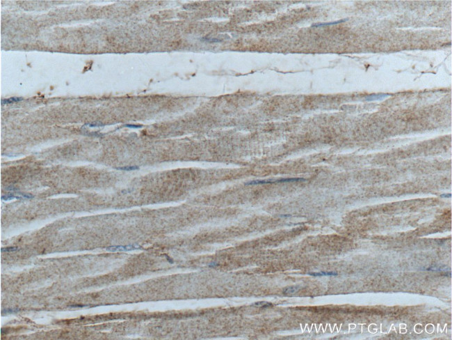 PHKA1 Antibody in Immunohistochemistry (Paraffin) (IHC (P))