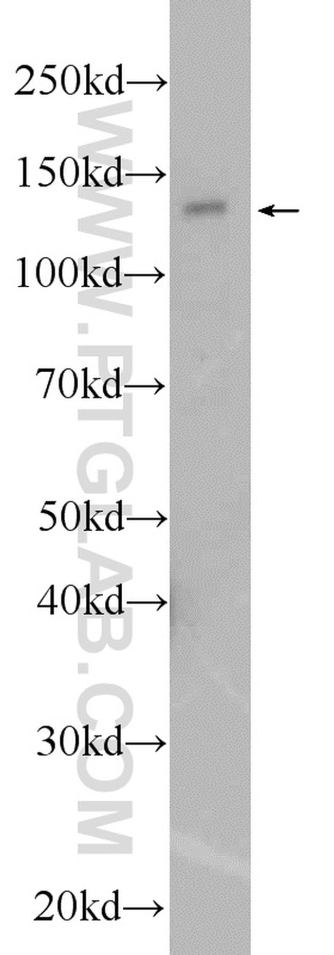 PHKA1 Antibody in Western Blot (WB)