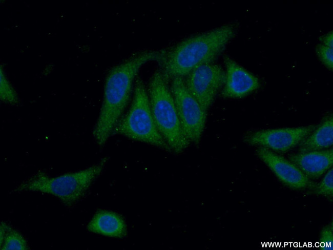 ANKRD53 Antibody in Immunocytochemistry (ICC/IF)