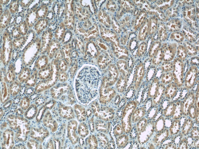 ANKRD53 Antibody in Immunohistochemistry (Paraffin) (IHC (P))