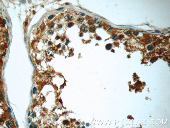 ANKRD53 Antibody in Immunohistochemistry (Paraffin) (IHC (P))