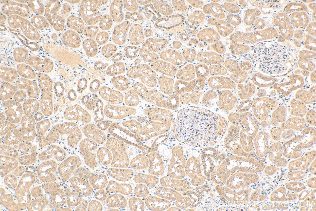 ANKRD53 Antibody in Immunohistochemistry (Paraffin) (IHC (P))