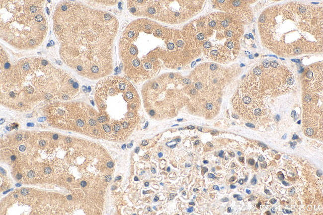 ANKRD53 Antibody in Immunohistochemistry (Paraffin) (IHC (P))