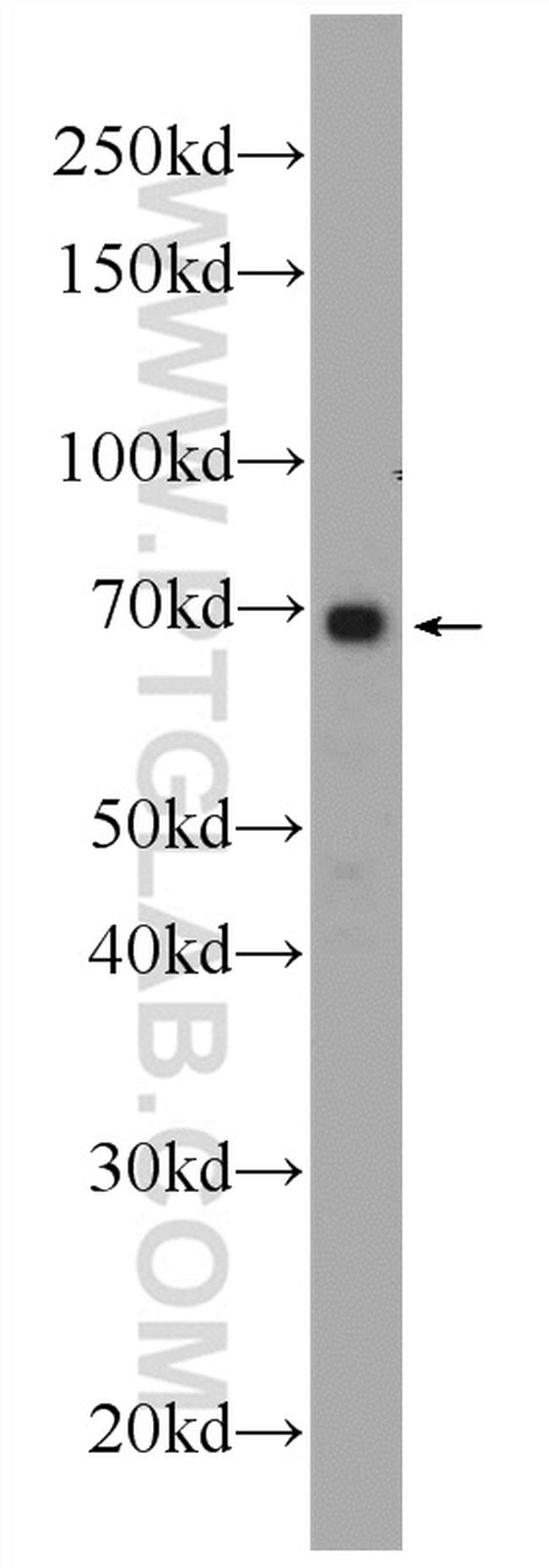 ANKRD53 Antibody in Western Blot (WB)