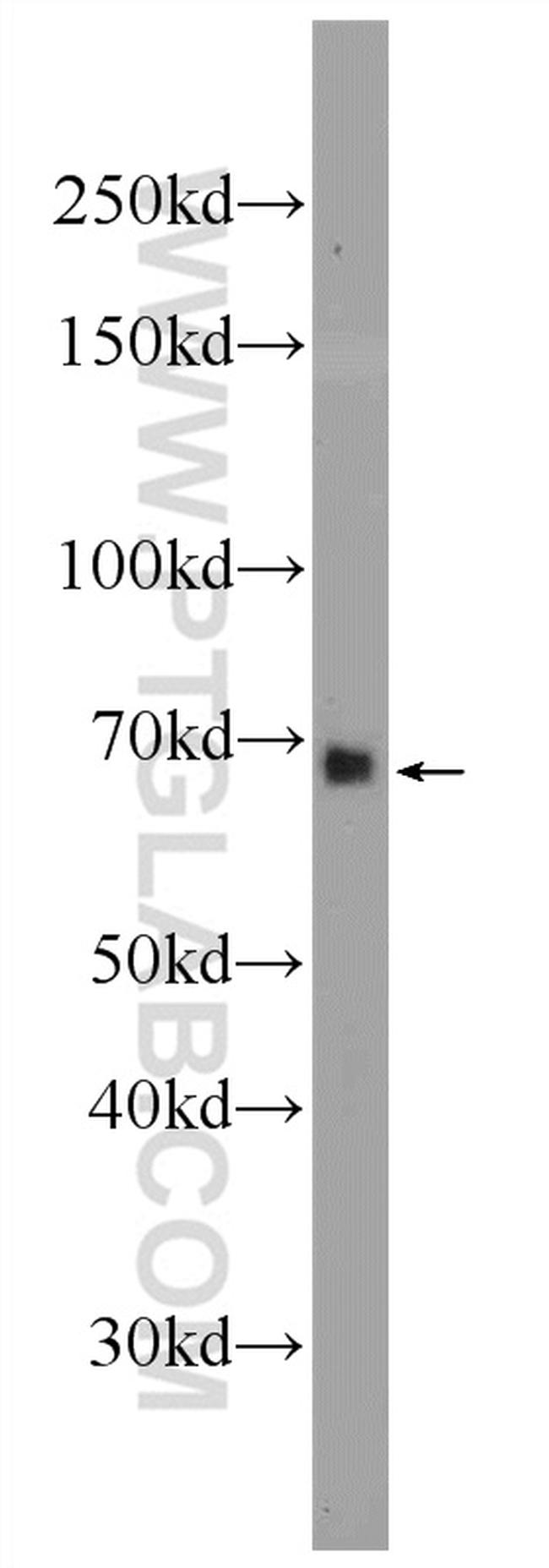 ANKRD53 Antibody in Western Blot (WB)