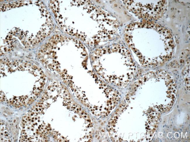 PAPOLG Antibody in Immunohistochemistry (Paraffin) (IHC (P))