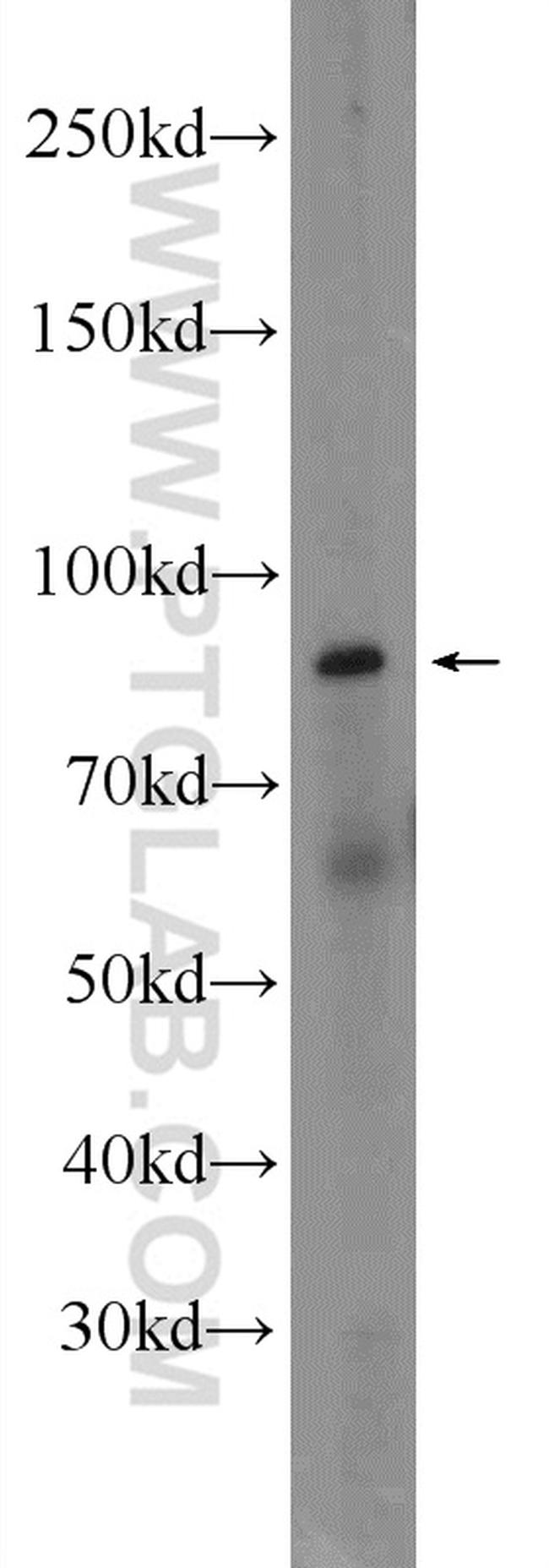 CSTF3 Antibody in Western Blot (WB)