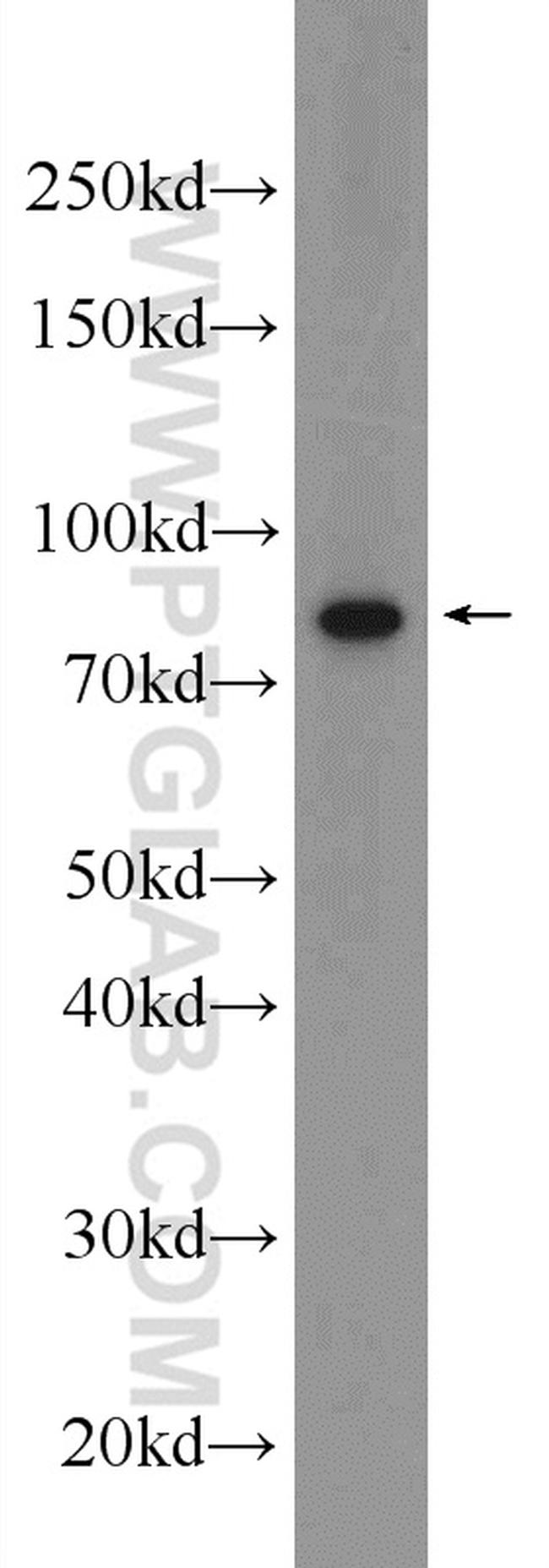 CSTF3 Antibody in Western Blot (WB)