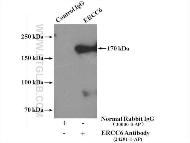 ERCC6/CSB Antibody in Immunoprecipitation (IP)