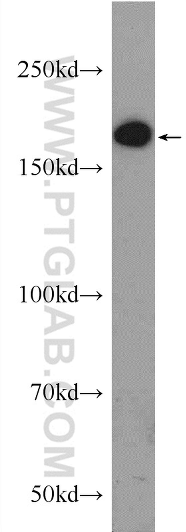 ERCC6/CSB Antibody in Western Blot (WB)