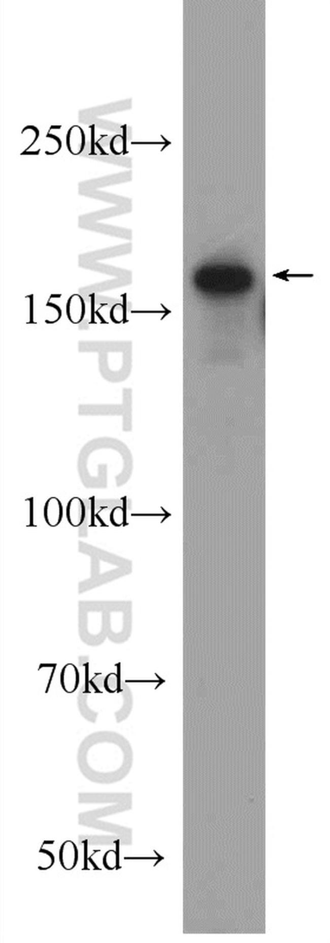 ERCC6/CSB Antibody in Western Blot (WB)