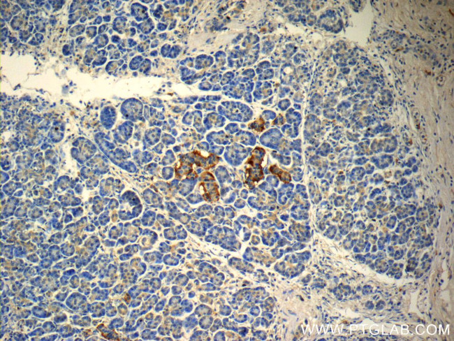 peptide YY Antibody in Immunohistochemistry (Paraffin) (IHC (P))