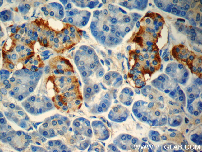 peptide YY Antibody in Immunohistochemistry (Paraffin) (IHC (P))