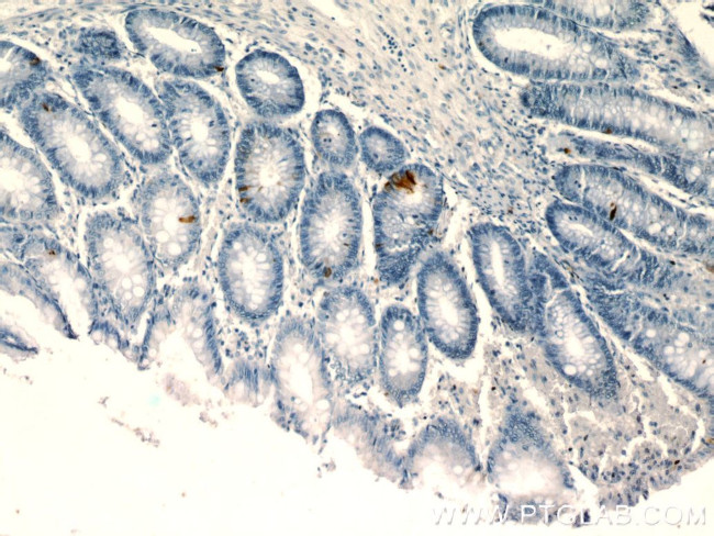 peptide YY Antibody in Immunohistochemistry (Paraffin) (IHC (P))