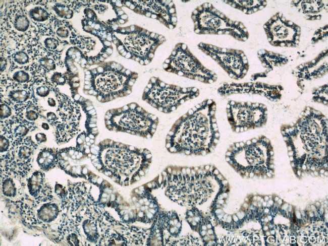 peptide YY Antibody in Immunohistochemistry (Paraffin) (IHC (P))