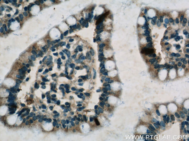 peptide YY Antibody in Immunohistochemistry (Paraffin) (IHC (P))