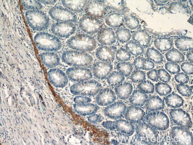 EFCAB5 Antibody in Immunohistochemistry (Paraffin) (IHC (P))