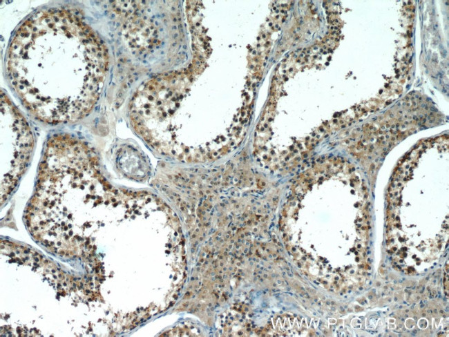 EFCAB5 Antibody in Immunohistochemistry (Paraffin) (IHC (P))