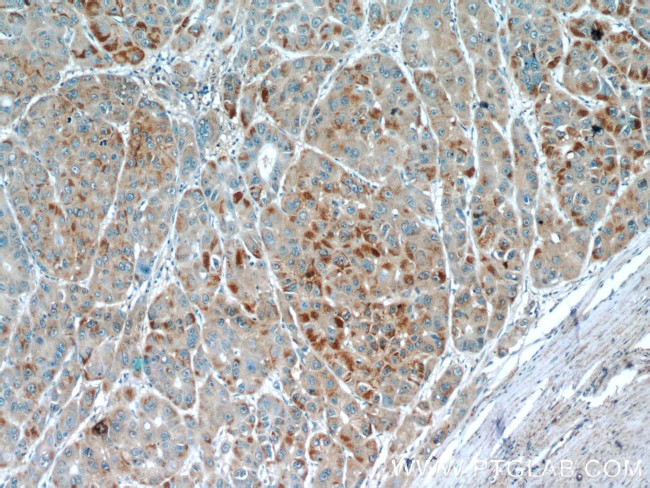 EFCAB5 Antibody in Immunohistochemistry (Paraffin) (IHC (P))