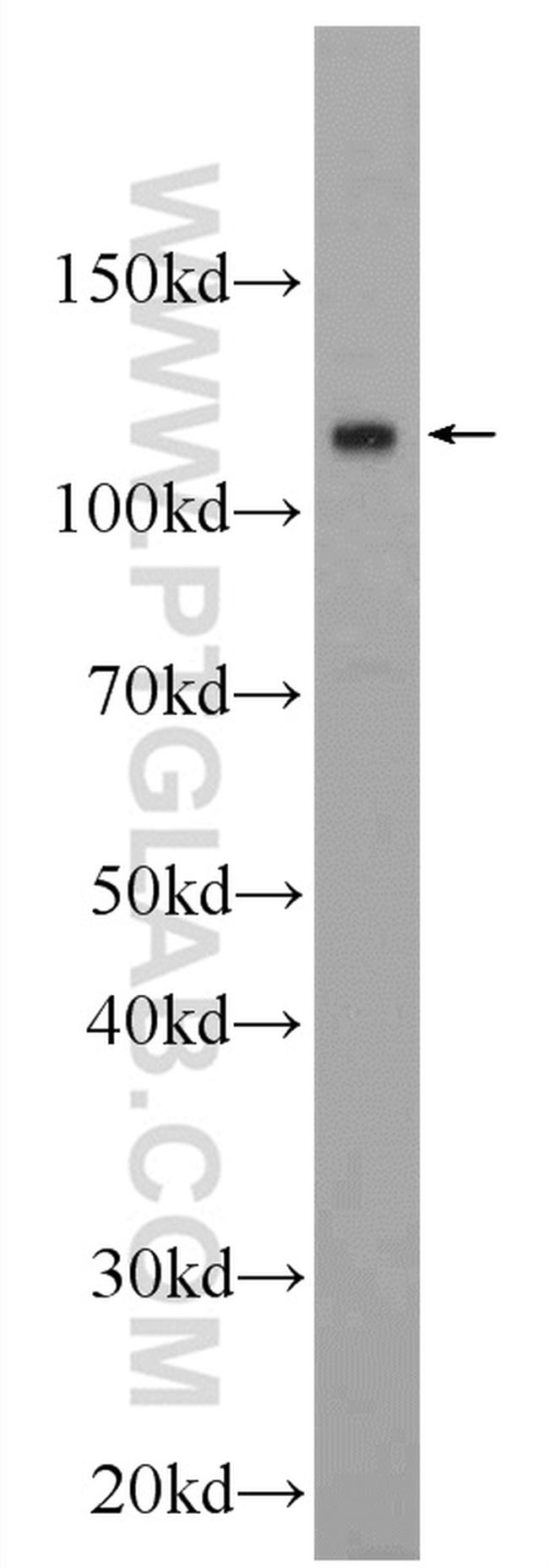 EFCAB5 Antibody in Western Blot (WB)