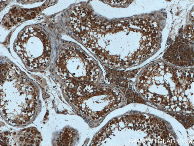 LIPI Antibody in Immunohistochemistry (Paraffin) (IHC (P))