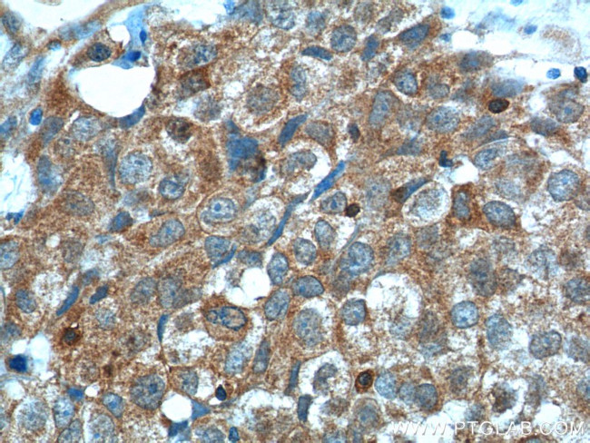 cIAP2 Antibody in Immunohistochemistry (Paraffin) (IHC (P))