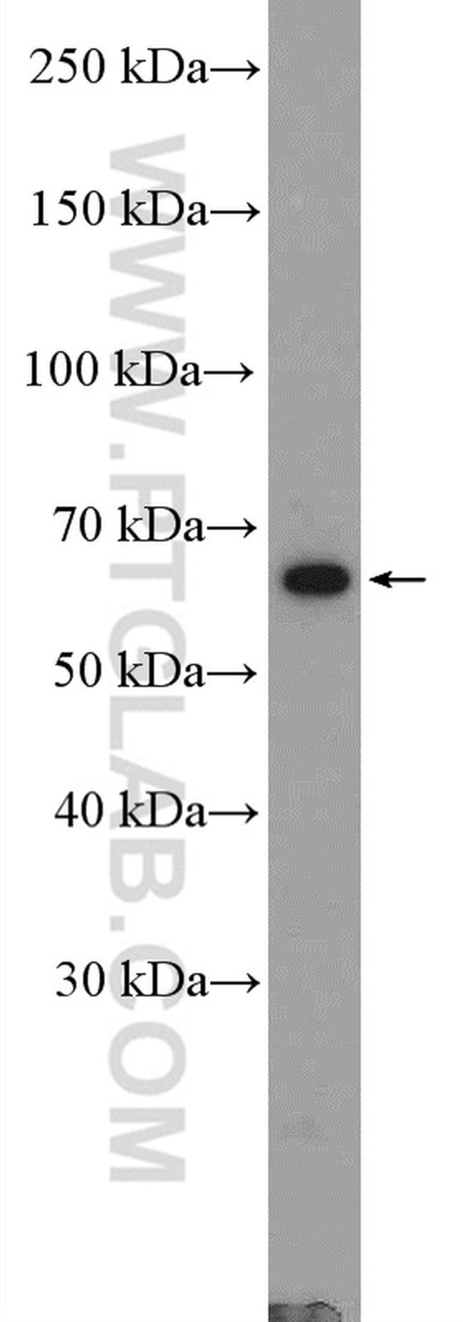 cIAP2 Antibody in Western Blot (WB)