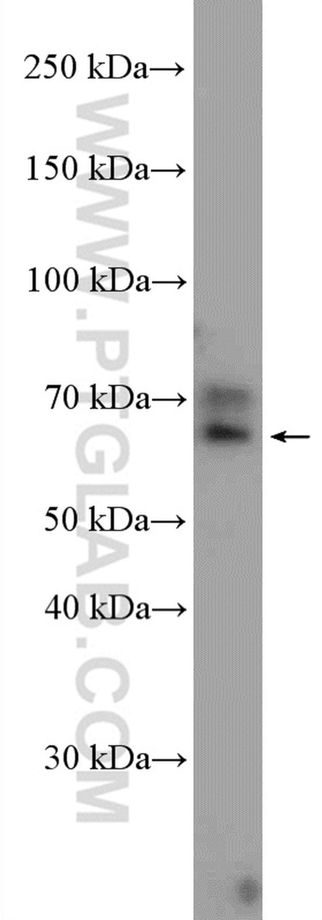 cIAP2 Antibody in Western Blot (WB)