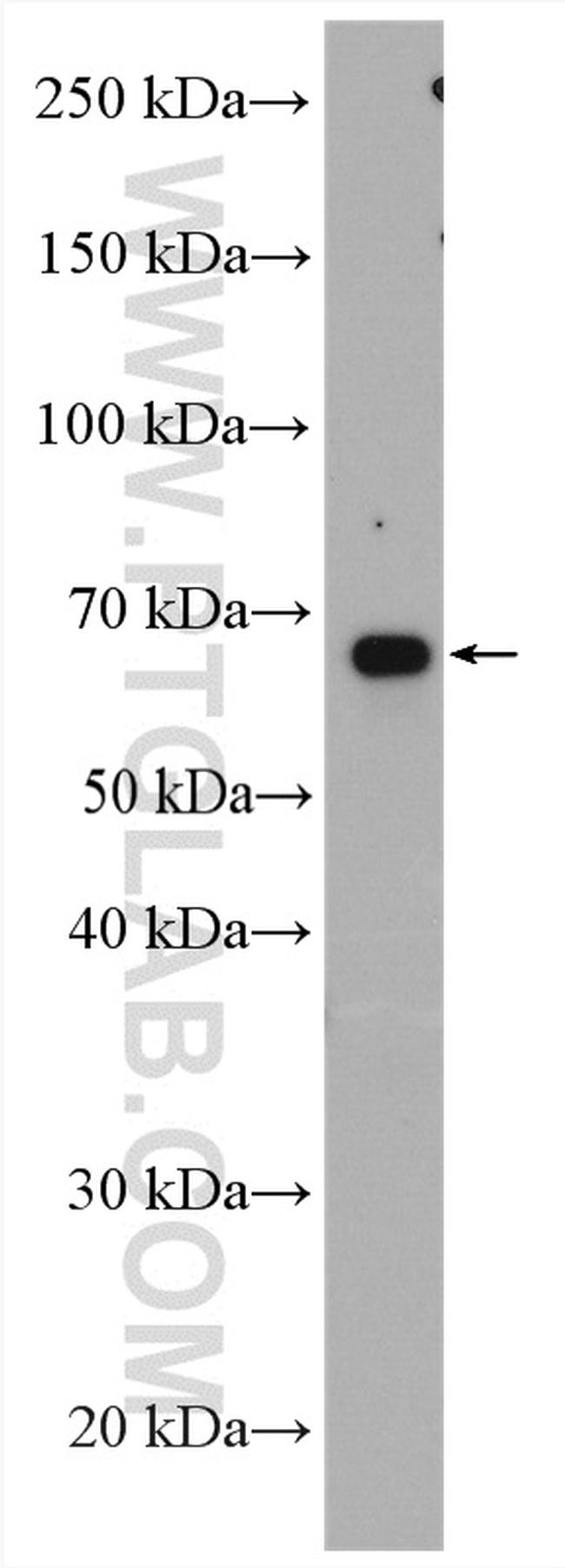 cIAP2 Antibody in Western Blot (WB)