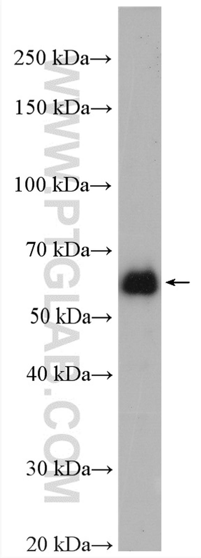 EEPD1 Antibody in Western Blot (WB)