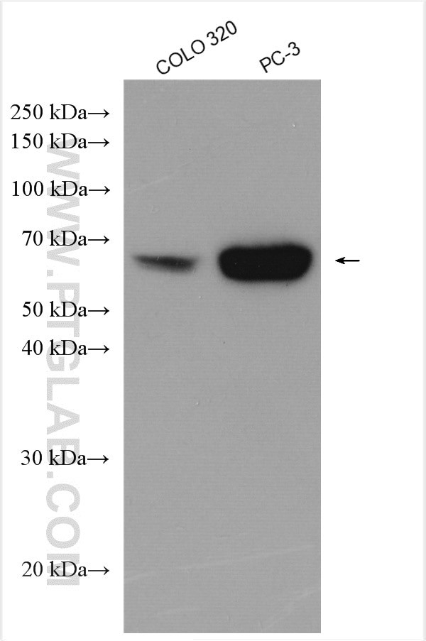 EEPD1 Antibody in Western Blot (WB)