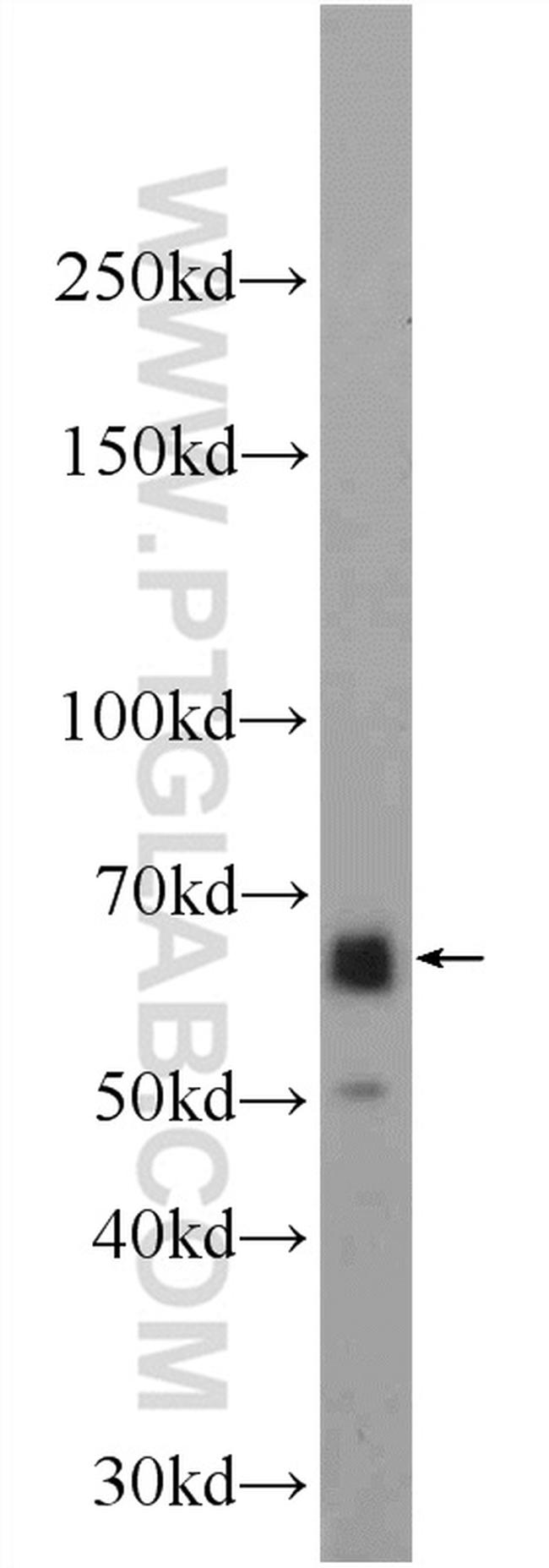 EEPD1 Antibody in Western Blot (WB)