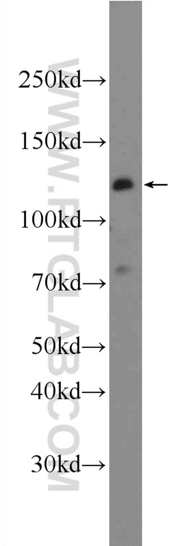 KDM2A Antibody in Western Blot (WB)