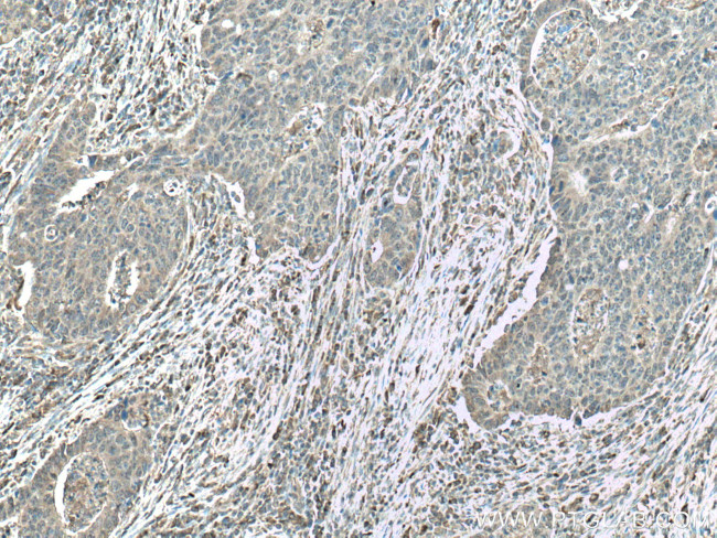 CAMK1 Antibody in Immunohistochemistry (Paraffin) (IHC (P))