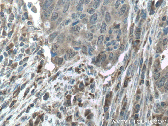 CAMK1 Antibody in Immunohistochemistry (Paraffin) (IHC (P))