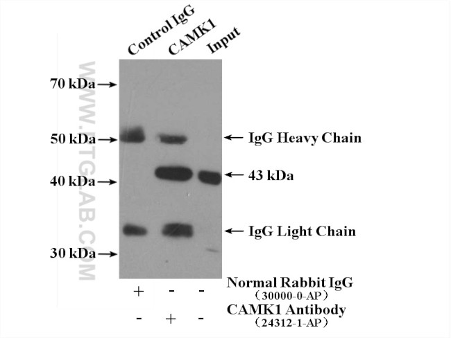 CAMK1 Antibody in Immunoprecipitation (IP)