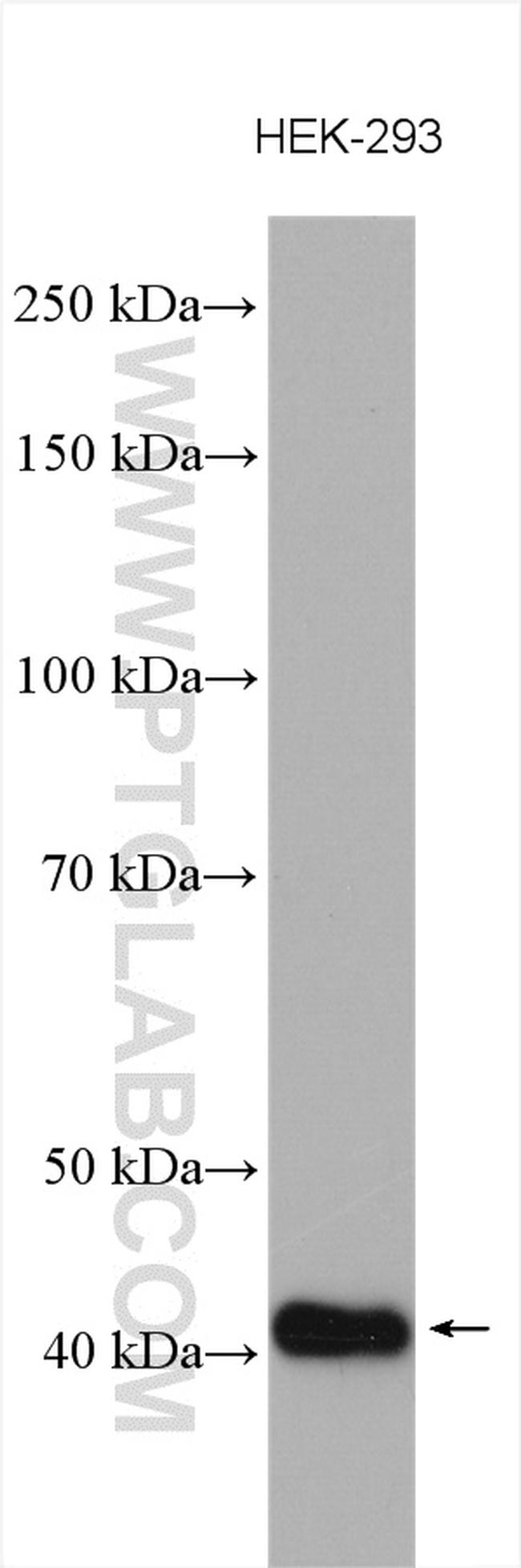 CAMK1 Antibody in Western Blot (WB)