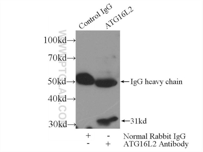 ATG16L2 Antibody in Immunoprecipitation (IP)