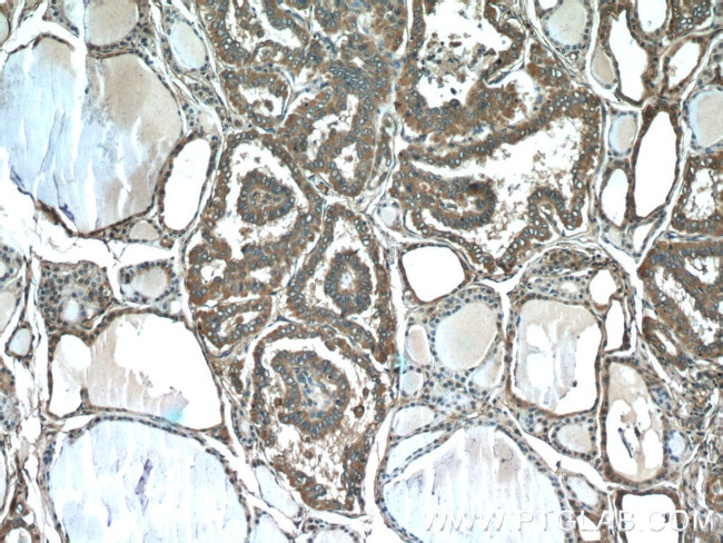 Sodium Iodide Symporter Antibody in Immunohistochemistry (Paraffin) (IHC (P))